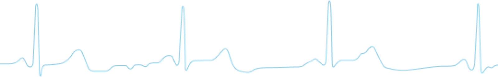 Normal heartbeat