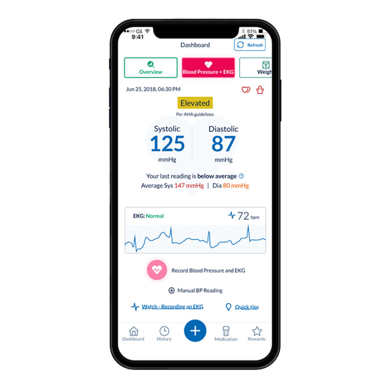 OMRON connect app | Dashboard on phone with elevated BP reading
